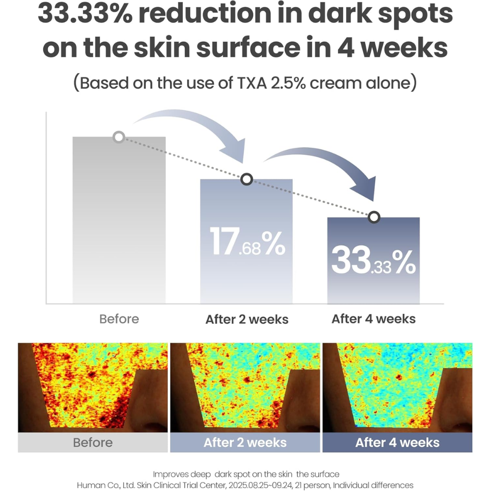 AXIS-Y TXA 2.5% Intensive Brightening Cream - Tranexamic Acid, Niacinamide & Glutathione for Hyperpigmentation & Dark Spot Concealer - Vegan Korean Skin Care Moisturizer Face Cream 50ml