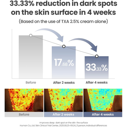 AXIS-Y TXA 2.5% Intensive Brightening Cream - Tranexamic Acid, Niacinamide & Glutathione for Hyperpigmentation & Dark Spot Concealer - Vegan Korean Skin Care Moisturizer Face Cream 50ml