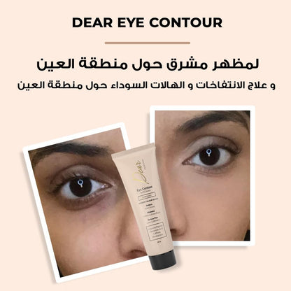 Dear Eye Soft Eye Contour Cream (Concealer) Medium Colour 30 ml