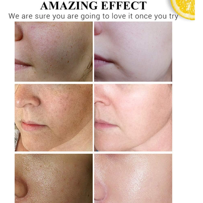 سيروم فيتامين سي وحمض الهيالورونيك من ديسار بيوتي 30 مل 