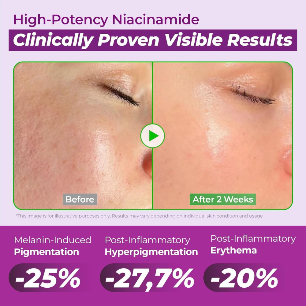 Jumiso Niacinamide 20% Serum 30ml | Dark Spot & Uneven Skin Tone Correcting Serum
