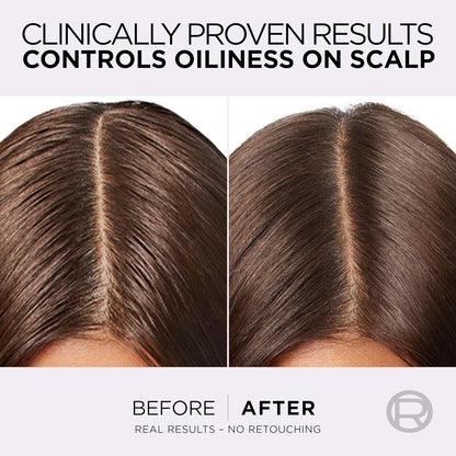 بلسم إلفيف هيالورون بيور من لوريال باريس للشعر الدهني 360 مل