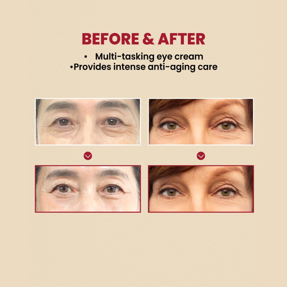 SEOUL 1988 Retinal Eye Cream with Retinal Liposome 4%, fermented bean for wrinkle care, anti-aging, brightening, 30ml.