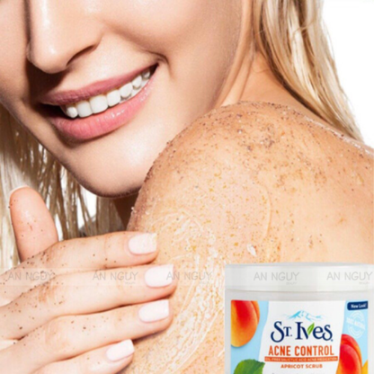 St. Ives Acne Control Apricot Scrub in 283g container, facial care with natural apricot exfoliants for clearer skin.