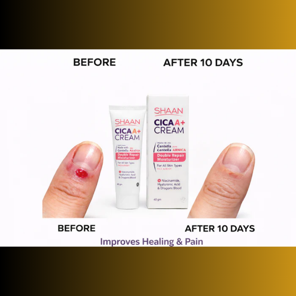 Shaan CICA ARNICA+ cream 40gm - belamoon