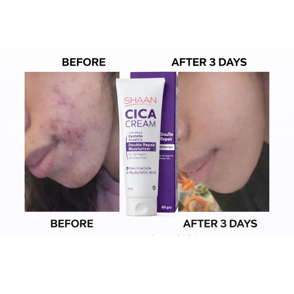 Shaan CICA Cream 60ml - belamoon
