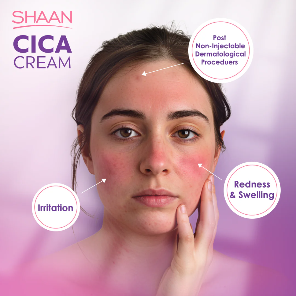 Shaan CICA Cream 60ml - belamoon