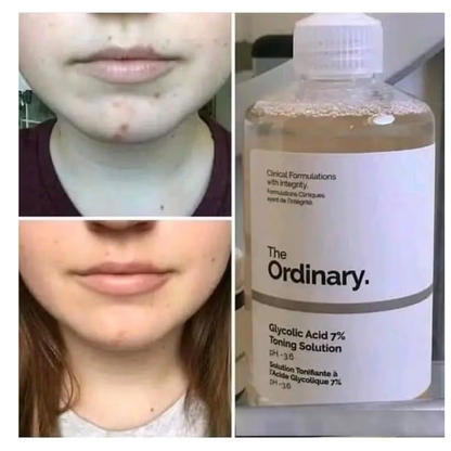 The Ordinary Glycolic Acid 7% Toning Solution in a 240ml bottle, facial care product for exfoliating and skin renewal.