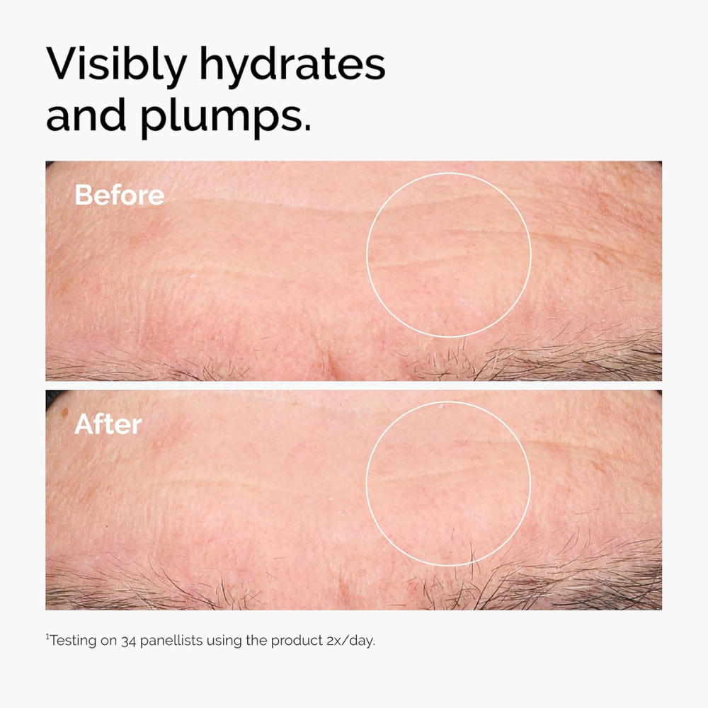 The Ordinary Hyaluronic Acid 2% + B5 facial serum bottle, clear 30ml container with dropper, for hydration and skin moisture.