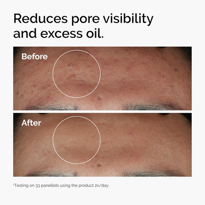 The Ordinary Niacinamide 10% and Zinc 1% facial serum in a clear 30ml bottle, showcasing the product label and packaging.